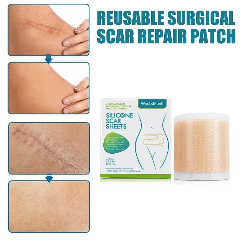 Miniatura 6 de Cinta De Silicona Para Quitar Cicatrices